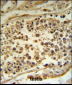 HFE Antibody (Center)
